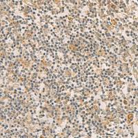 兔抗RAB13多克隆抗体