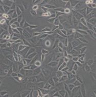 小鼠肝星状细胞HSC/mHSC