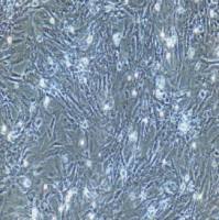 支气管平滑肌细胞