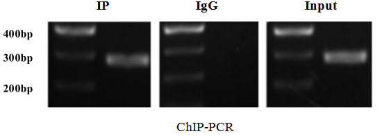 染色质免疫沉淀(ChIP)试剂盒(ChIP kit (植物)
