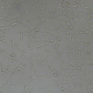 小鼠星形胶质瘤细胞SMA-560