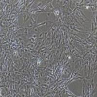 脑微血管内皮细胞