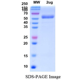 Recombinant SARS-CoV-2 S Protein RBD, C-Fc Tag (B.1.1.529/Omicron)
