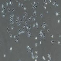 少突小胶质细胞