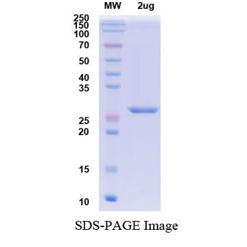 Recombinant SARS-CoV-2 S Protein RBD, N-His Tag (B.1.1.529/Omicron)