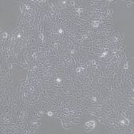 人胚肾细胞293T/17