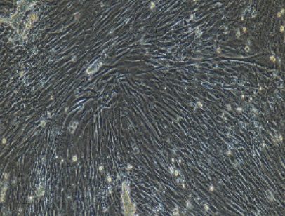 腹腔主动脉平滑肌细胞