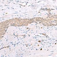 兔抗RBM26多克隆抗体