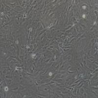 滑膜成纤维细胞