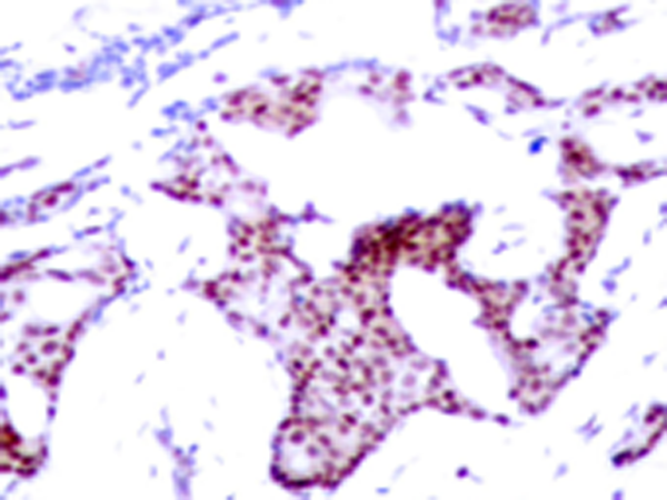 兔抗RELA(Phospho-Ser276)多克隆抗体