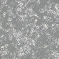 人大细胞肺癌细胞NCI-H661