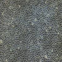 乳腺导管上皮细胞