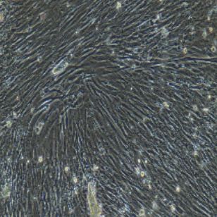 腹腔主动脉平滑肌细胞