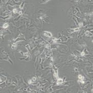 人多发性骨髓瘤细胞U266B1