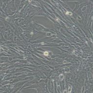 小鼠主动脉平滑肌细胞MOVAS-1