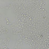 人正常前列腺基质永生化细胞WPMY-1