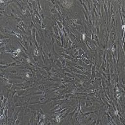 滑膜间充质干细胞