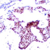 兔抗RELA(Phospho-Ser276)多克隆抗体