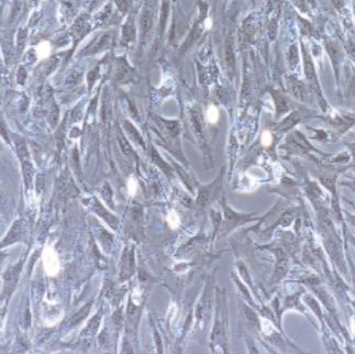 小肠平滑肌细胞