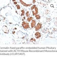 重组小鼠单克隆抗体 (rCLIP/1407),Purified, with BSA,0.2 mg