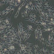 人肺小细胞癌细胞NCI-H647