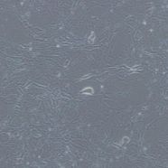 人神经母细胞瘤细胞IMR-32