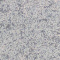小鼠单核巨噬细胞白血病细胞Raw264.7