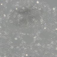 小鼠淋巴结血管上皮样细胞SVEC4-10