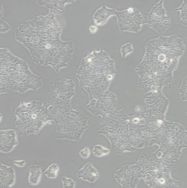人肺癌细胞NCI-H1703