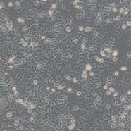人胎盘间充质干细胞HPMSC