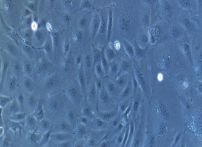 视网膜色素上皮细胞