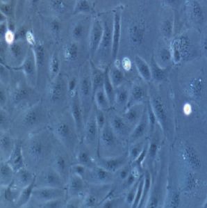 视网膜色素上皮细胞