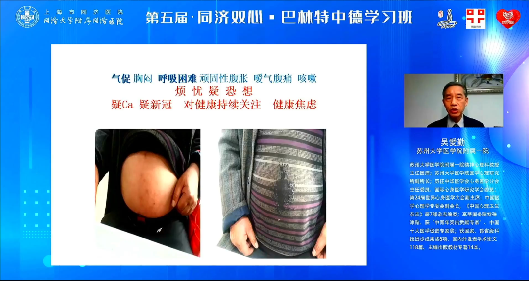 同济大学附属同济医院召开第五届中德同济双心·巴林特学习班