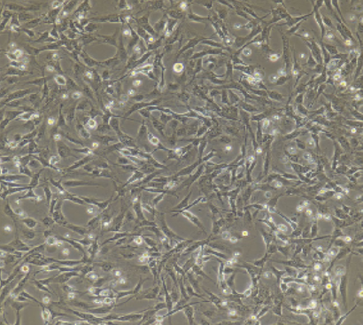 脐静脉内皮细胞