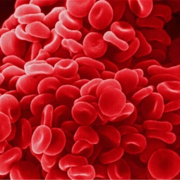 红细胞裂解液
