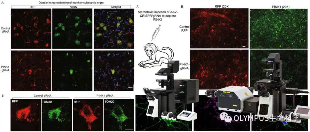 李晓江团队：利用猴模型发现遗传性帕金森疾病新机制