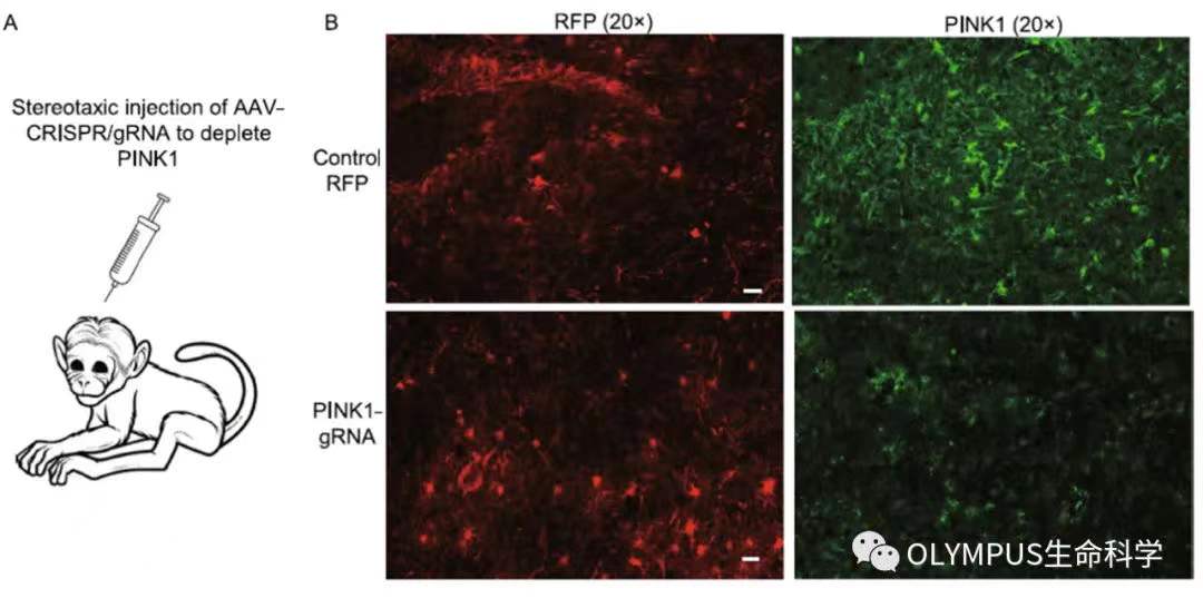李晓江团队:利用猴模型发现遗传性帕金森疾病新机制