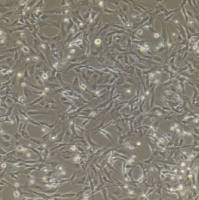 脐静脉内皮细胞