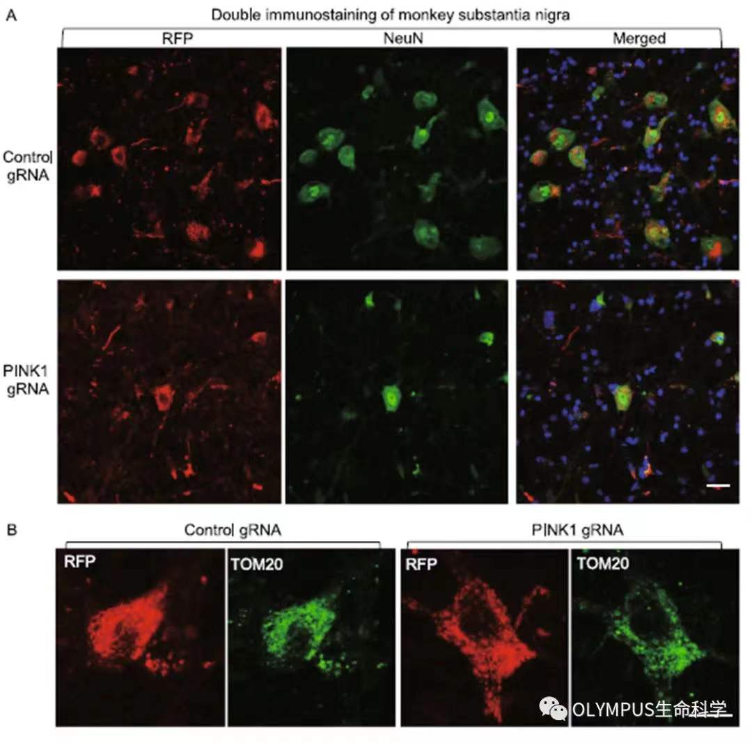 李晓江团队:利用猴模型发现遗传性帕金森疾病新机制