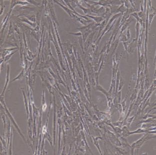 骨髓间充质干细胞
