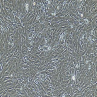 脂肪微血管内皮细胞