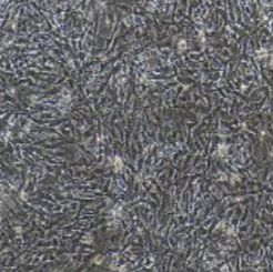 兔眼微血管内皮细胞