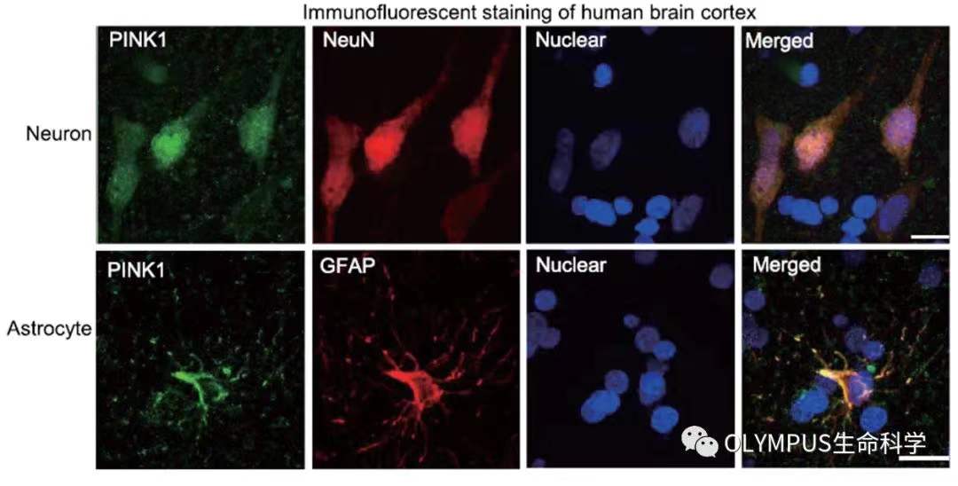 李晓江团队:利用猴模型发现遗传性帕金森疾病新机制