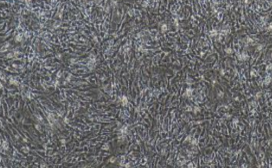 兔眼微血管内皮细胞