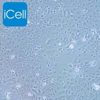 KYSE150 人食管癌细胞/KYSE-150细胞/KYSE-150/KYSE150细胞/KYSE150/STR鉴定