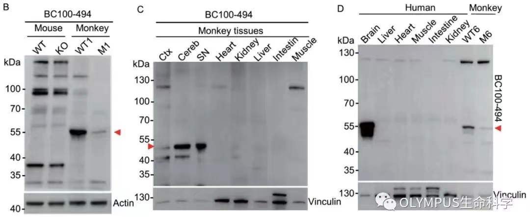 李晓江团队:利用猴模型发现遗传性帕金森疾病新机制