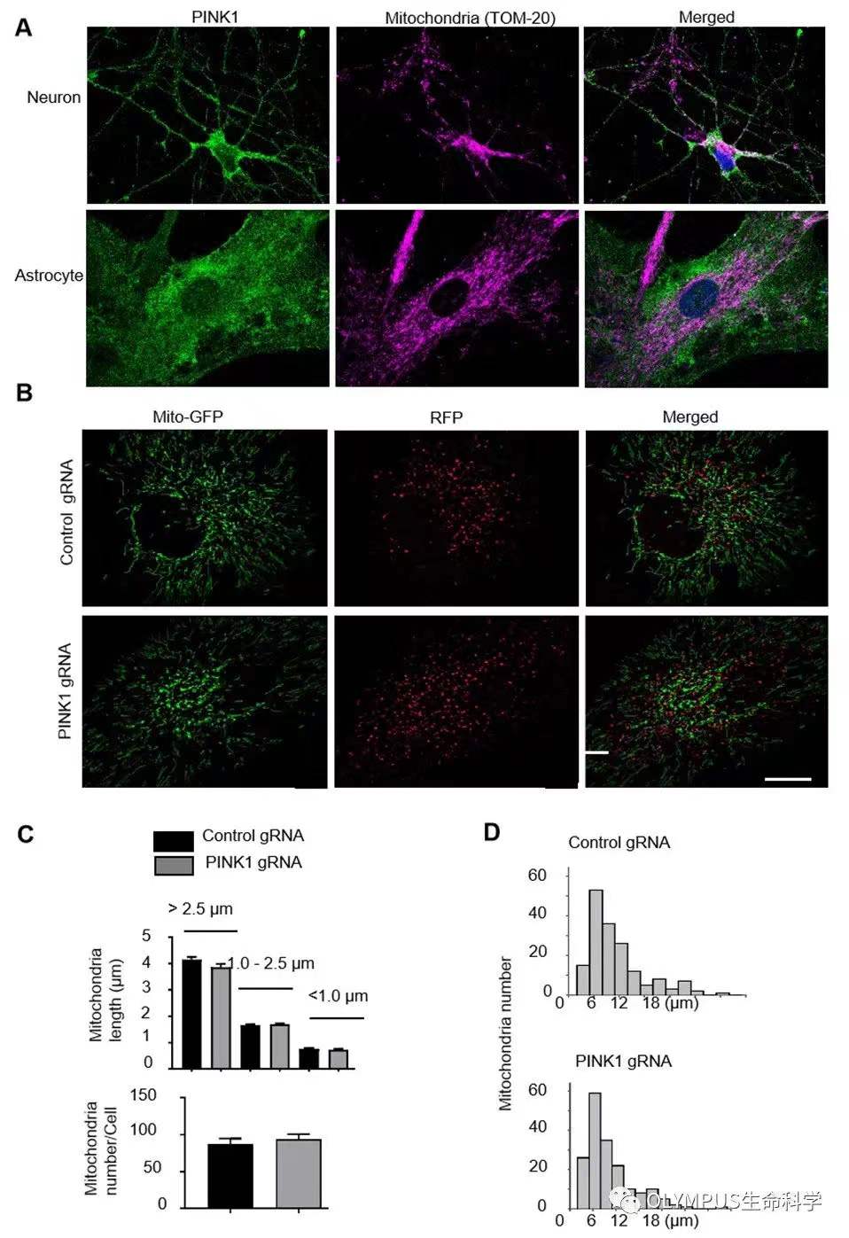 李晓江团队:利用猴模型发现遗传性帕金森疾病新机制