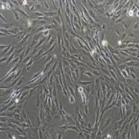 人乳腺癌成纤维细胞永生化