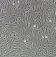 人肝窦内皮细胞永生化