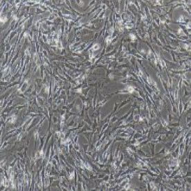 小鼠肾小球系膜细胞永生化